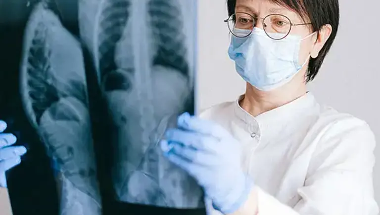 Masked doctor holds up and examines a chest X-ray